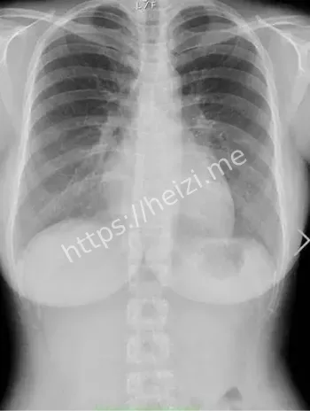 二次元天乳争议粉丝热议