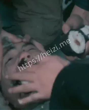 731部队细菌实验真相