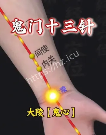 传统针灸安神镇静神经