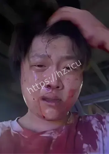 精神小伙黑料视频