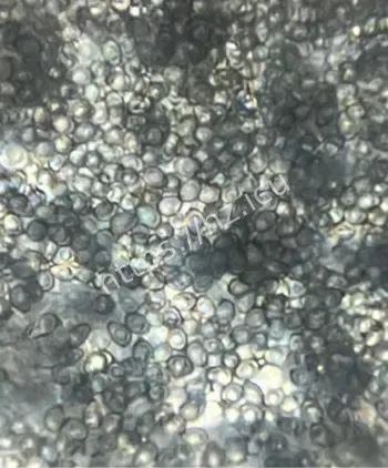 大果鹅膏剧毒科普